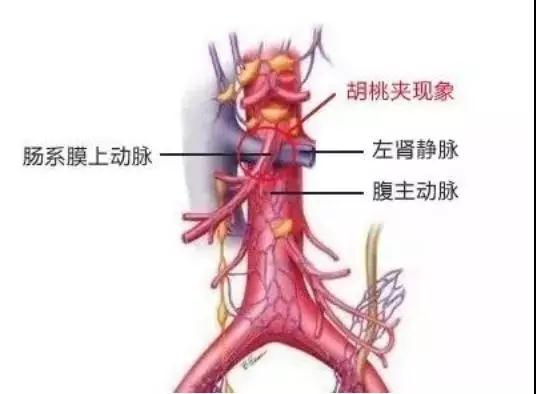 胡桃夾