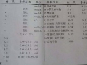 教你怎麽看尿常規化(huà)驗單？