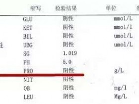 尿蛋白的(de)檢查怎麽看？