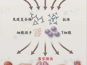 狼瘡腎炎得(de)病的(de)原因是什(shén)麽？平時(shí)需要注意什(shén)麽？